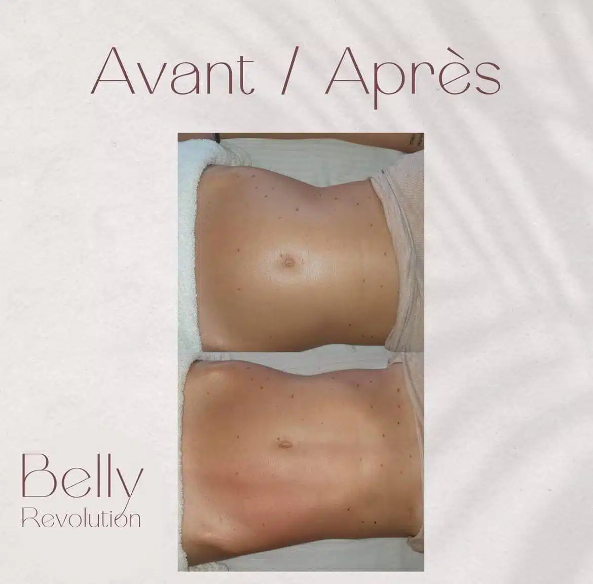 Photo numéro 4 de la galerie de Frédérique Minguet : Masseur bien-être à Rilly-la-Montagne. Prendre RDV