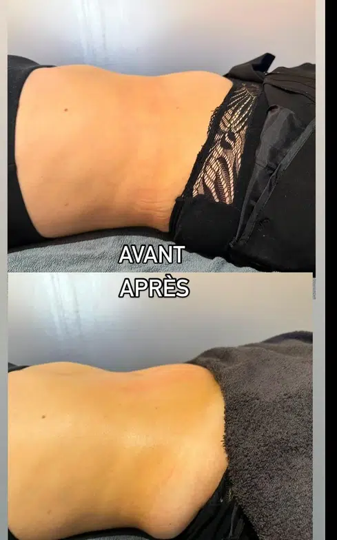 Photo numéro 2 de la galerie de Anissa Bougoufa : Masseur bien-être à Villefranche-sur-Saône. Prendre RDV